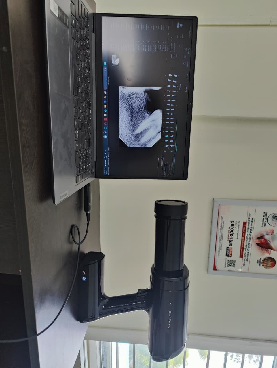 Digital X-Ray Setup